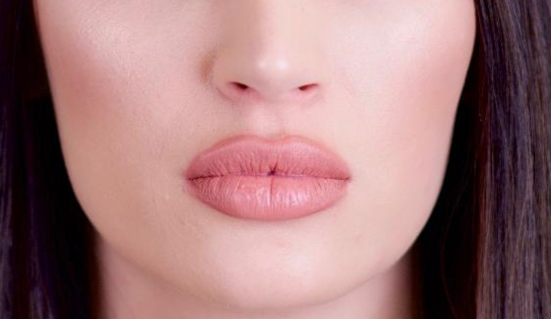 Patient ready for dissolve dermal fillers (lips), ACM Clinic Adelaide