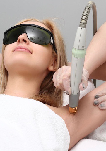 Laser hair removal treatment 02