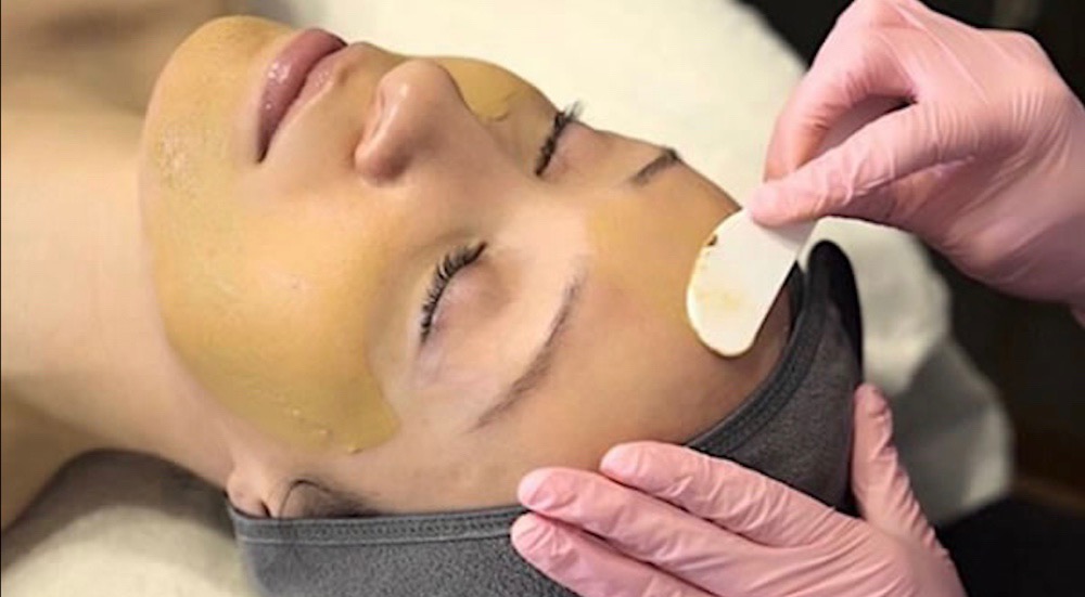 Cosmelan treatment at ACM Clinic in Adelaide 02