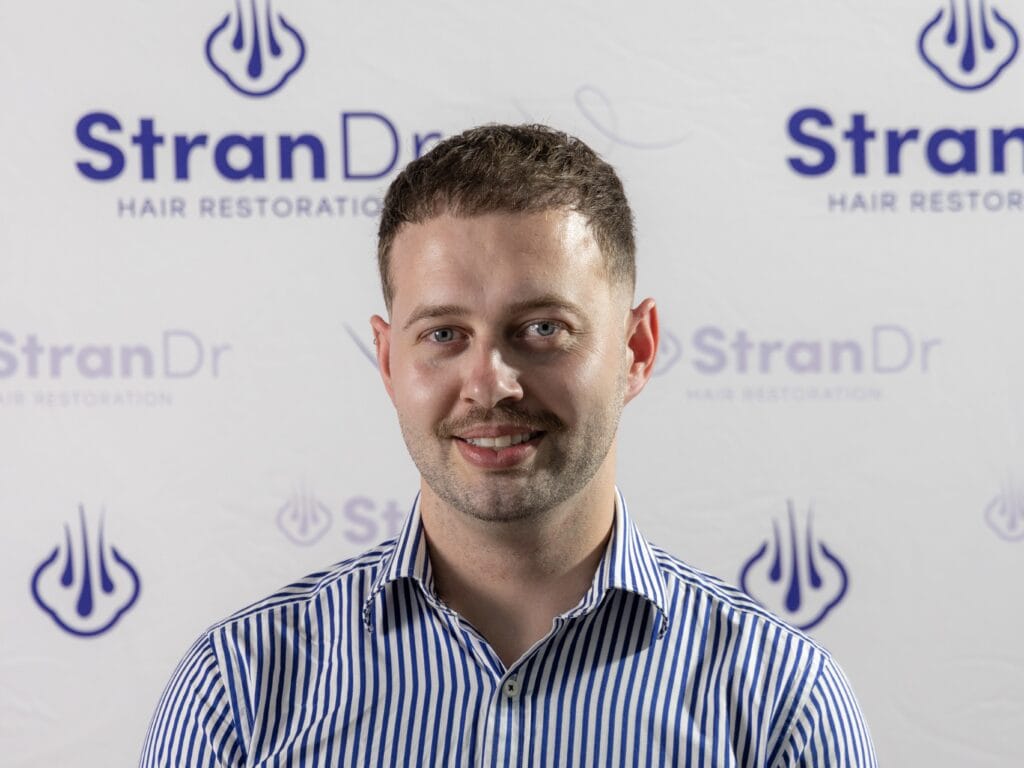 HAIR TRANSPLANT ADELAIDE AFTER