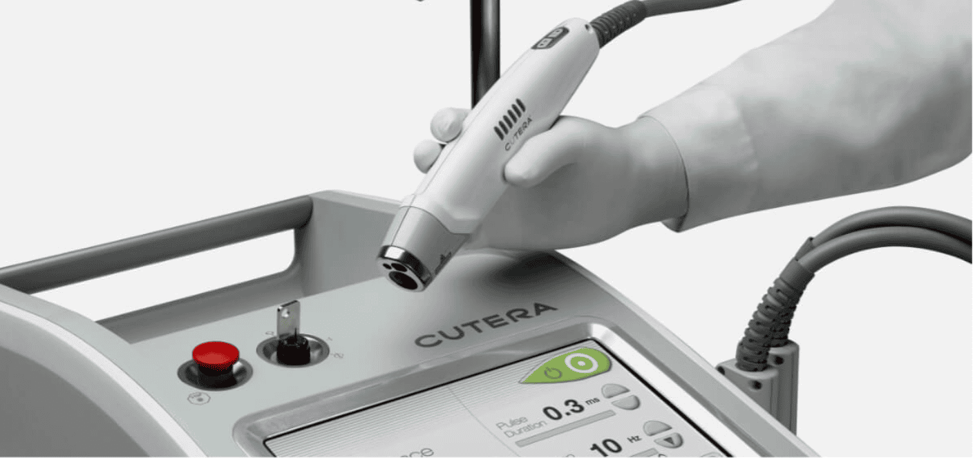 Cutera Excel V Laser